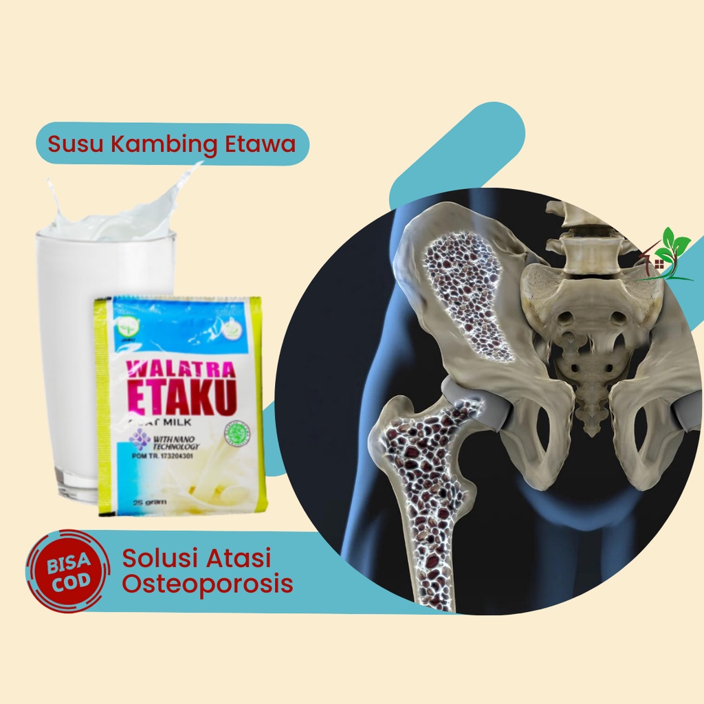 

Walatra Etaku, Susu untuk Osteoporosis, Susu untuk Pengapuran Tulang, Susu Menguatkan Tulang Keropos, Obat Tulang Rapuh, Obat Pengapuran Tulang, Obat Osteoporosis, Obat Tulang Keropos, Susu Kambing Etawa