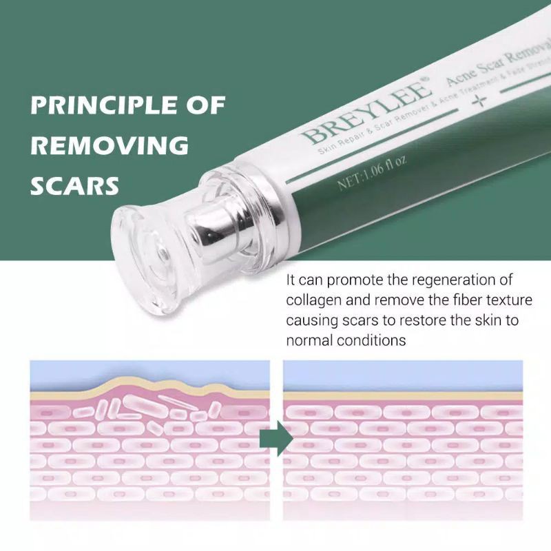 Breylee Acne Scar Removal Cream Menghilangkan Bekas Luka / Stretch Marks 30g