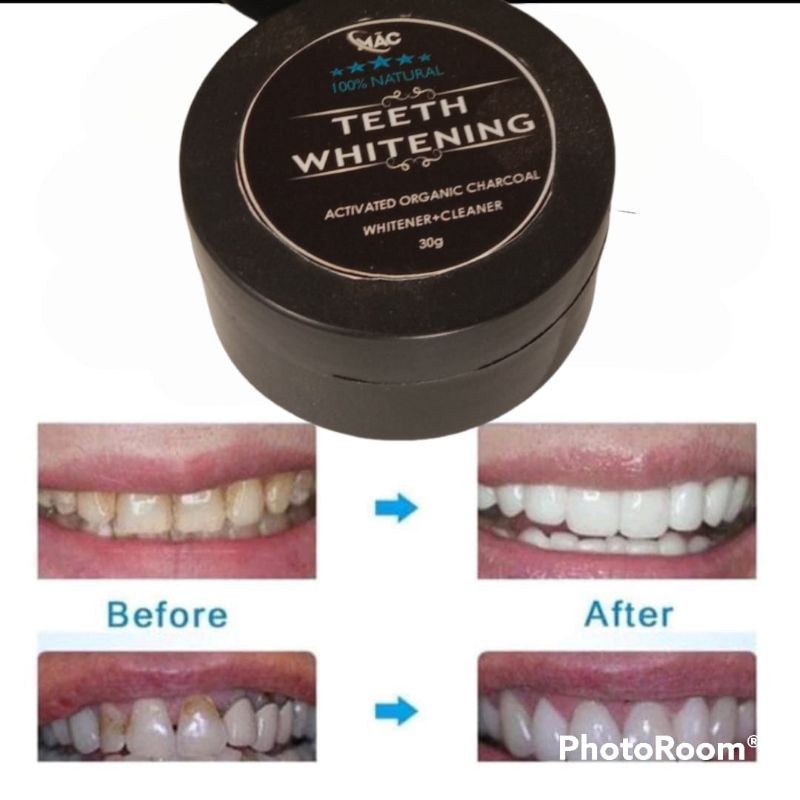 Pemutih Gigi Permanen Asli Viral,Teeth Whitening chorcoal charcoal original/obat perontok Karang Gigi