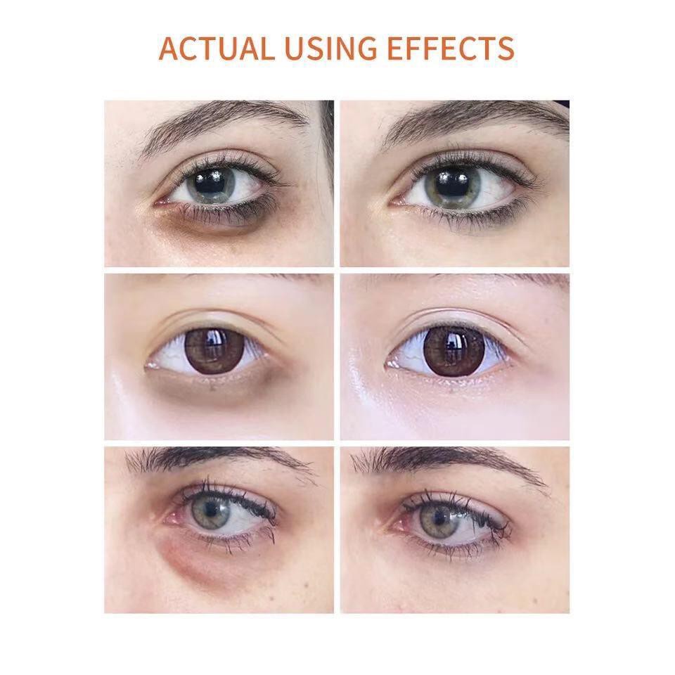 Breylee Retinol Eye Serum Mata Improve Eye Bags Anti-aging Lifting + Firming Eye Care 15ml