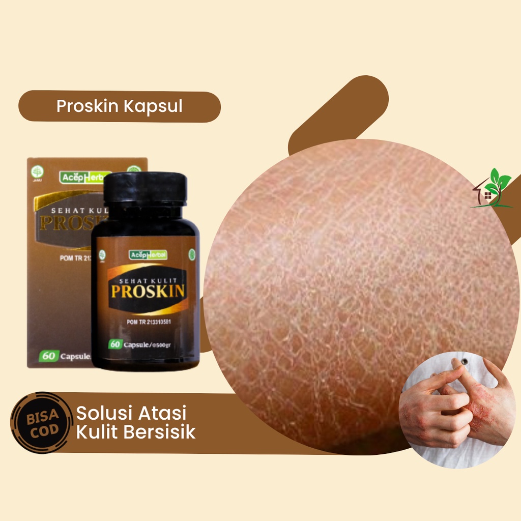 Obat Kulit Bersisik, Obat Kulit Kering dan Bersisik, Obat Kulit Kering dan Mengelupas, Obat Kulit Ke