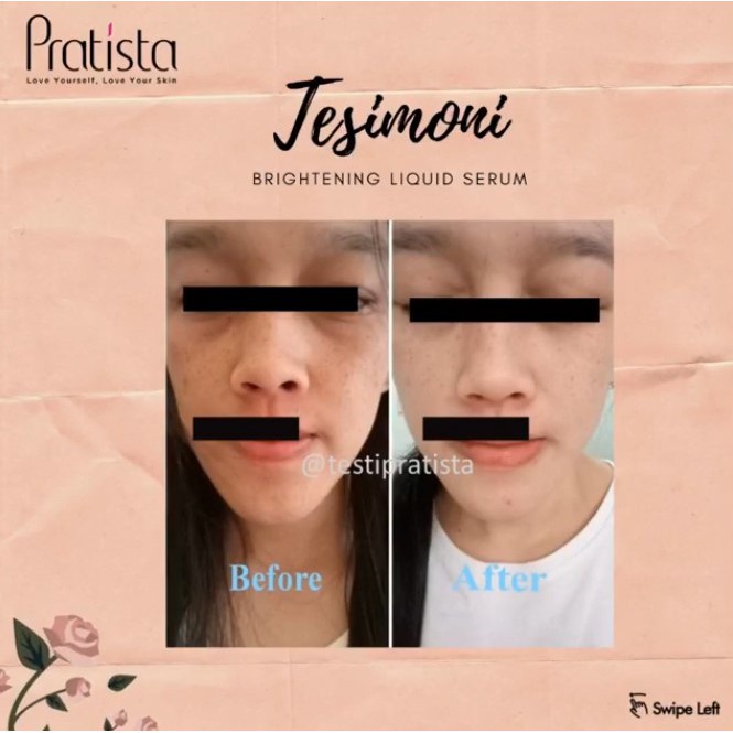 PRATISTA Brightening Liquid Serum 10ml BLS Pratista Skincare Serum Wajah Penghilang Flek Hitam Pencerah Wajah Ori BPOM