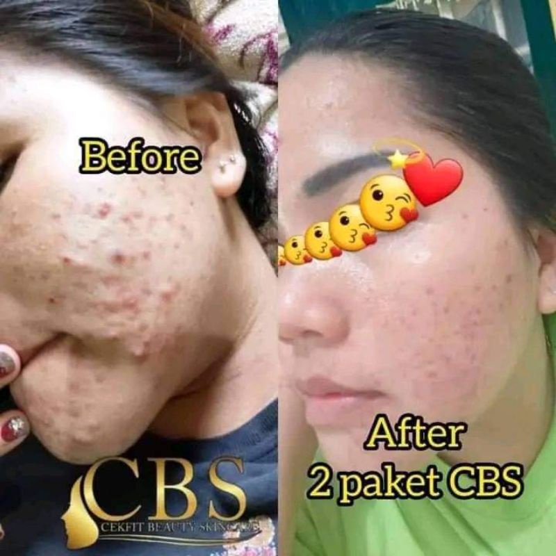 SKINCARE CBS (Cekfit Beauty Skincare) Sudah BPOM