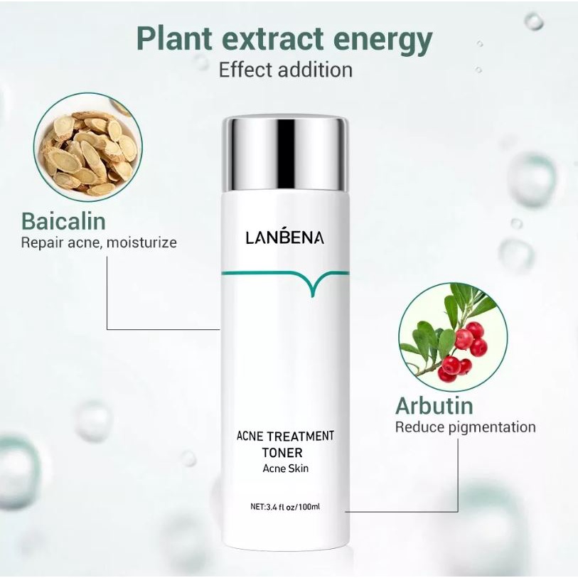 (READY &amp; ORI) LANBENA ACNE TREATMENT TONER ACNE SKIN LB5744 PENYEGAR WAJAH MENCERAHKAN