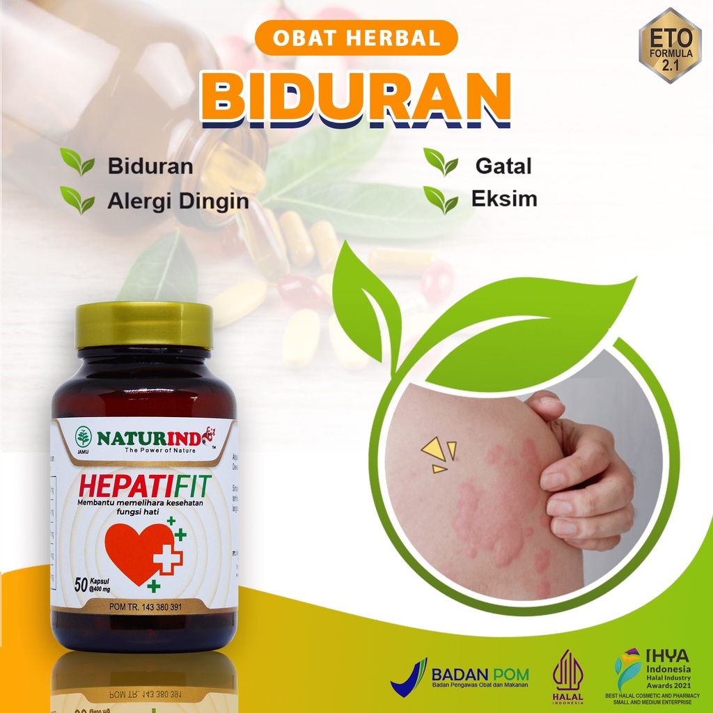 Obat Biduran Alergi Ampuh Gatal Biduran Kronis Menahun Kaligata Obat Eksim Kering Basah Menahun Pali