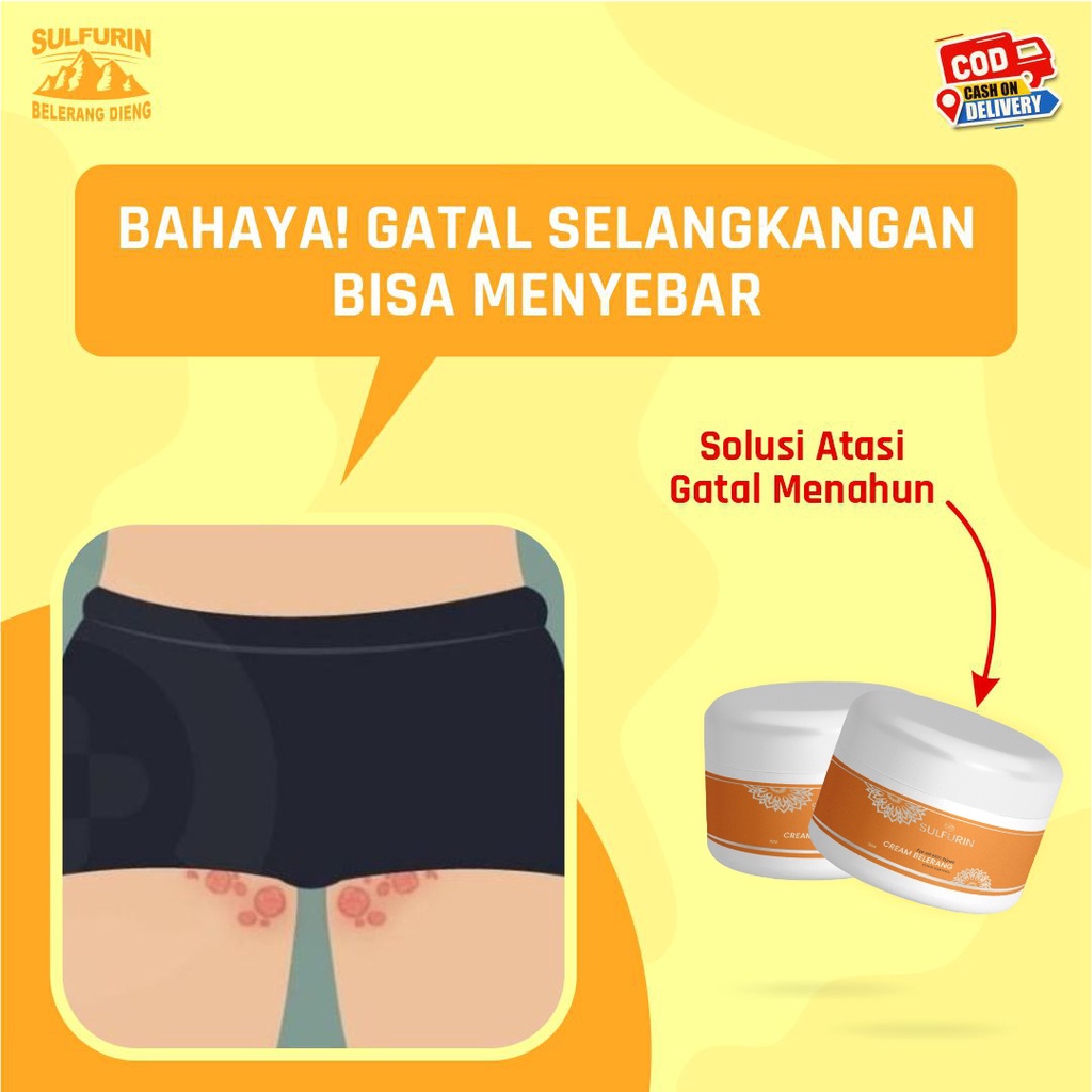 Salep/Cream Sulfurin Belerang Obat Kulit Gatal Kurap Kadas Ampuh