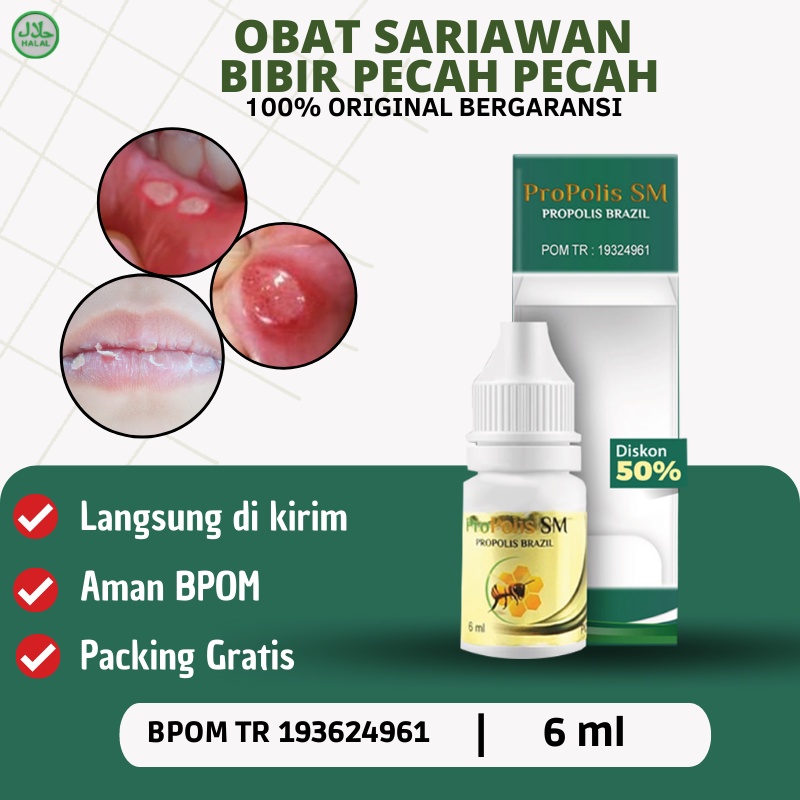 Propolis SM - Obat Sariawan, Obat Sariawan lidah dewasa, Obat sariawan mulut, Obat Bibir pecah pecah