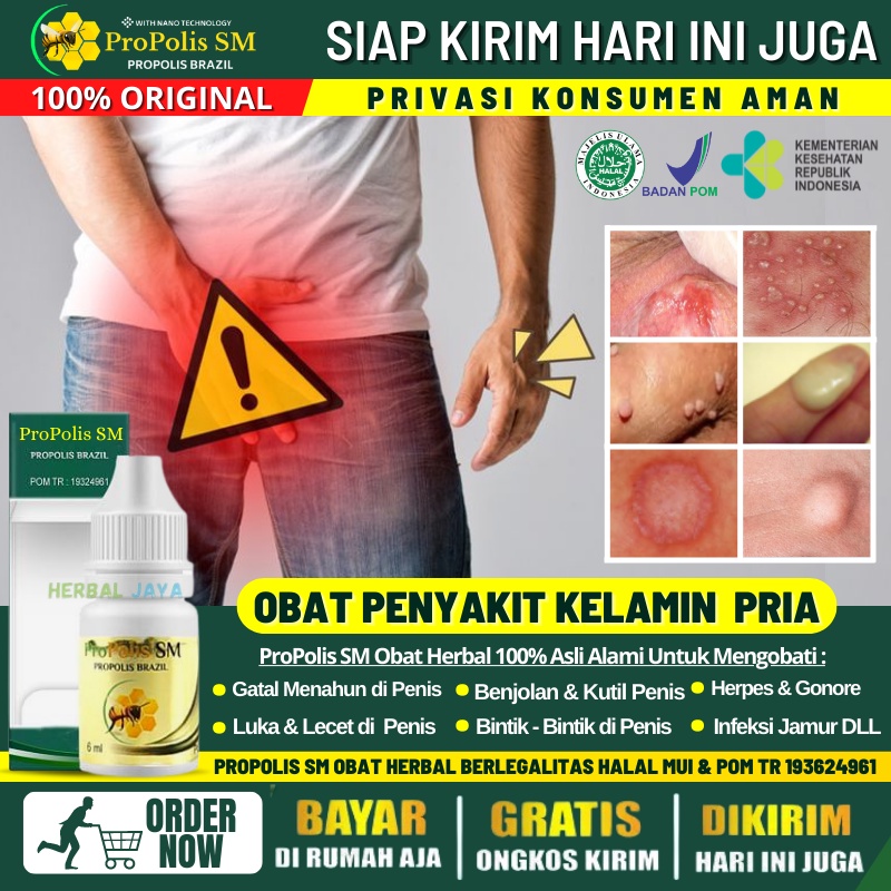 Obat Oles Sariawan di Penis Kemaluan, Obat Pengering Luka di Kemaluan Pria, Obat Penis Lecet Berair,