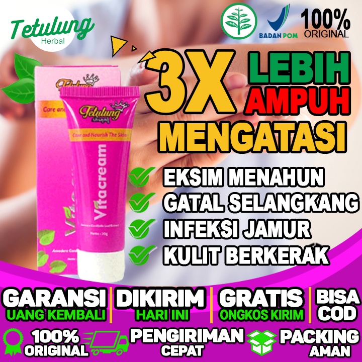 obat oles Vitacream Binahong Obat Gatal Selangkangan Obat Selangkangan Gatal Dan Hitam