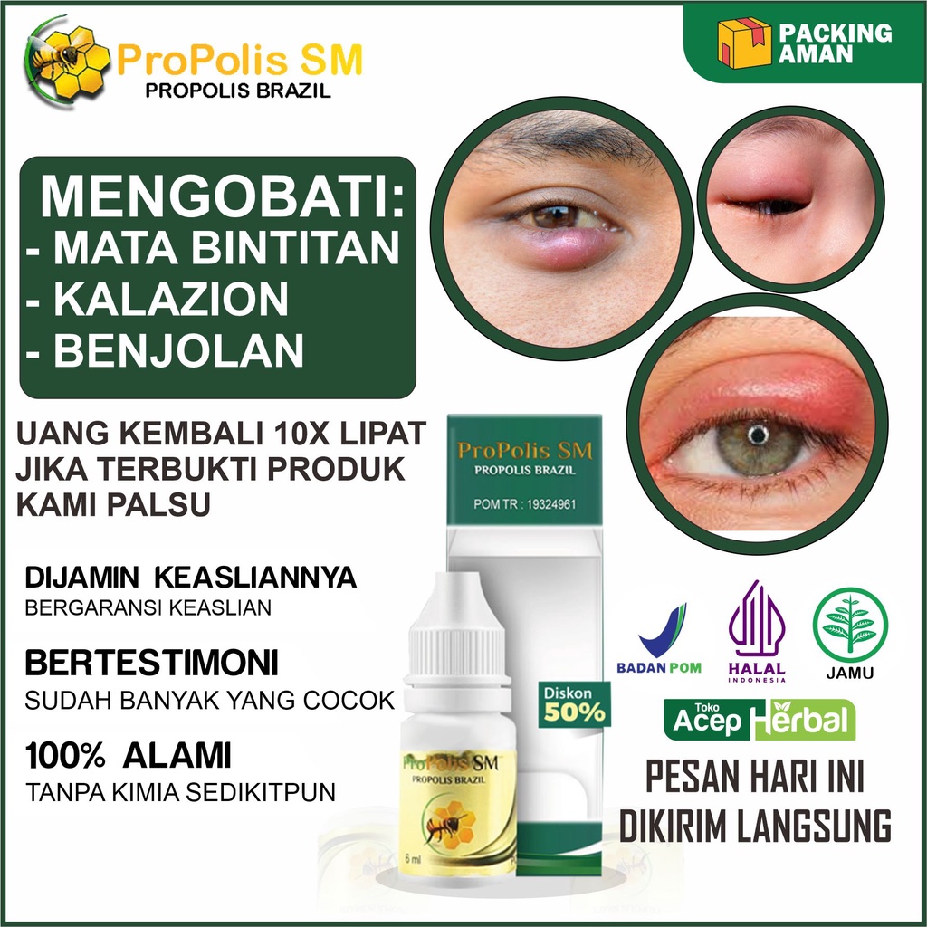 Jual Obat Mata Bengkak Obat Mata Bintitan Obat Mata Kalazion Obat Mata ...