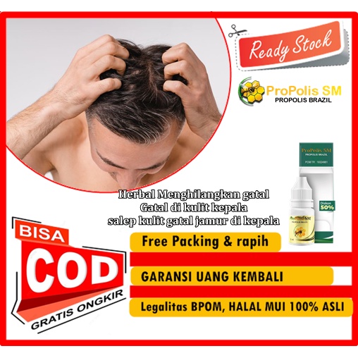 Herbal Menghilangkan gatal Gatal di kulit kepala, salep kulit gatal jamur di kepala, obat alergi kul