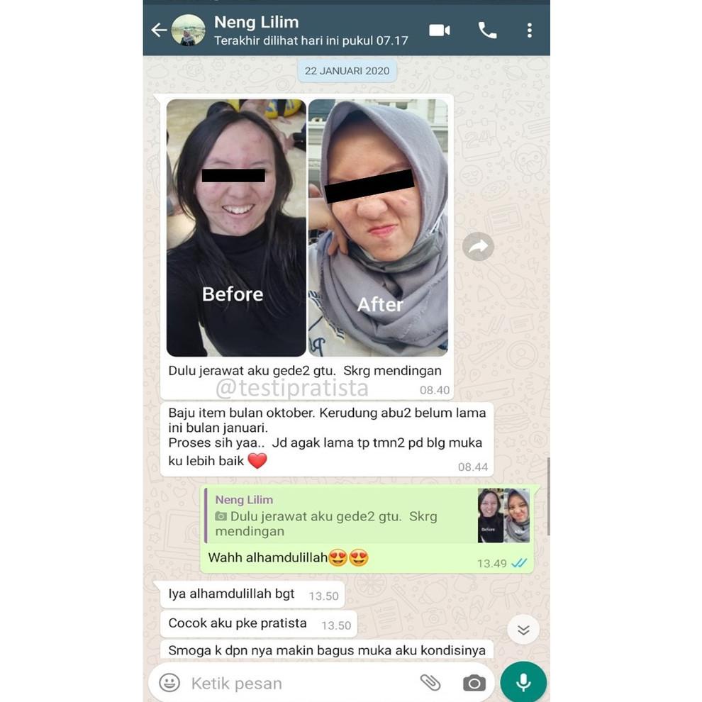 NEW ARRIVAL ㊫ Acne Lotion Pratista Indonesia ◈