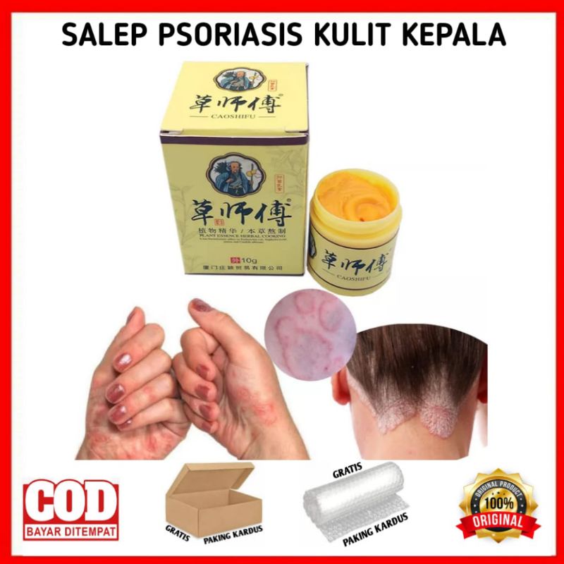SALEP PSORIASIS KULIT KEPALA OBAT PSORIASIS KULIT KEPALA