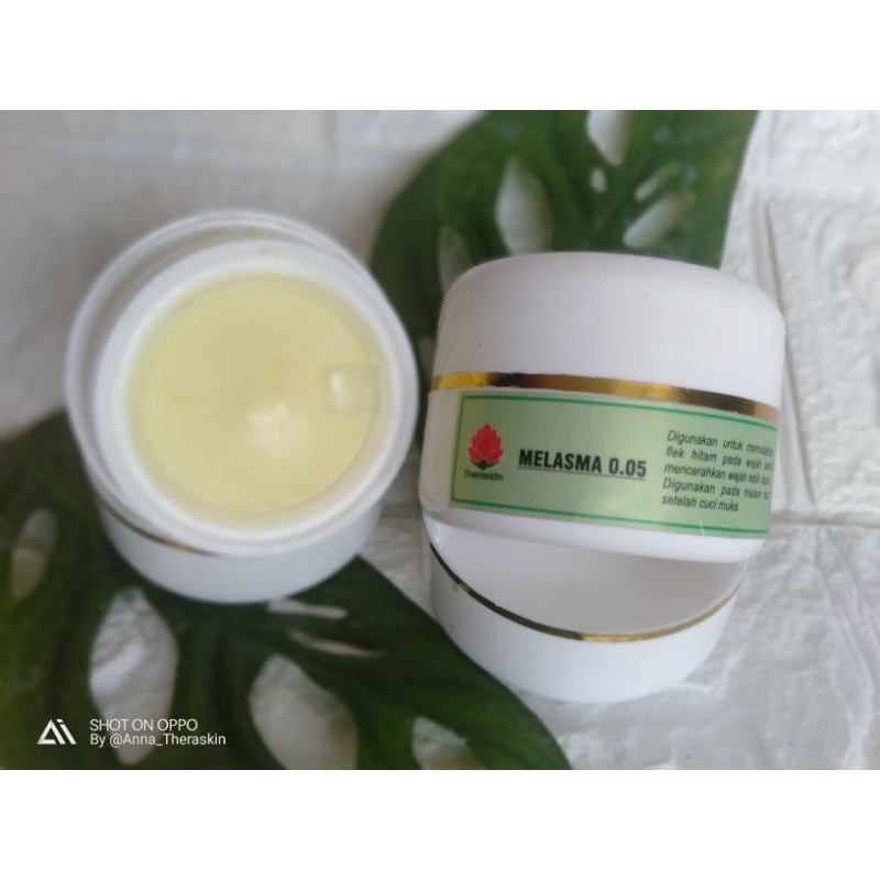 MELASMA FLEK FARMASI (CREAM MALAM)