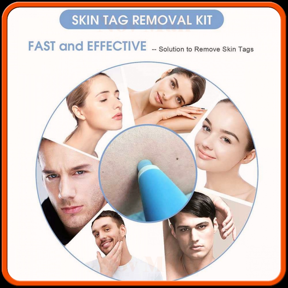 Alat Penghilang Kutil Painless Skin Tag Mole Removal Kit -BY006