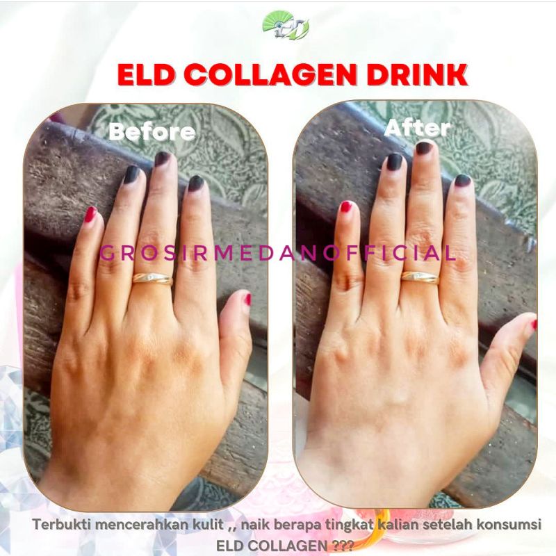 ELD COLLAGEN DRINK - LANGSING DAN PUTIH - MINUMAN KECANTIKAN UNTUK MERAWAT KULIT WAJAH, TUBUH, DAN RAMBUT