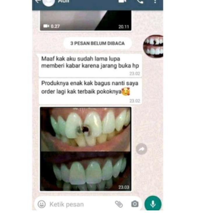 [KD7]TOOTH DECAY (penumbuh gigi ompong-gigi berlubang)-SALE!!