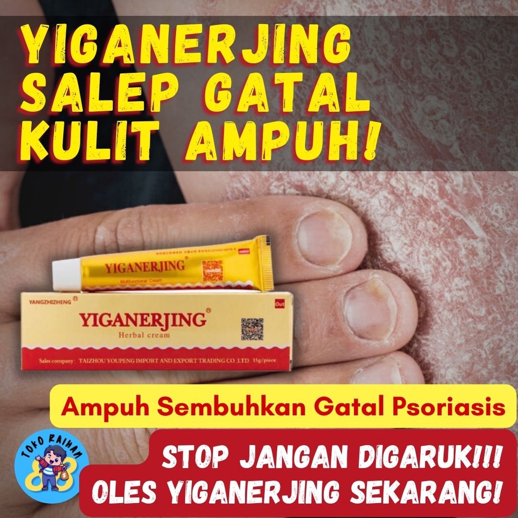 Salep Gatal Yiganerjing Cream Obat Gatal Kulit Herbal Original Kemasan Baru Indonesia