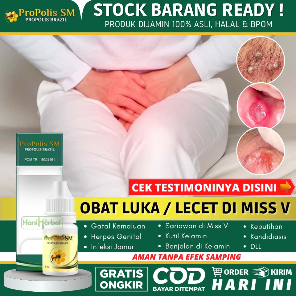 Propolis SM Brazil Obat Oles Luka Lecet di Vagina 100% Alami (Tidak Perih Saat Dioles), Obat Vagina 