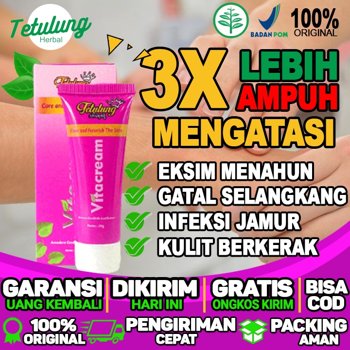Krim Untuk Ruam Gatal Cream Untuk Gatal Selangkangan Krim Untuk Perut Gatal Saat Hamil