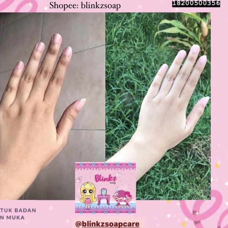 Dijamin Asli [FREE GIFT]  BLINKZ SOAP BPOM READY STOCK SABUN BLINKZ BLINK [AV2]