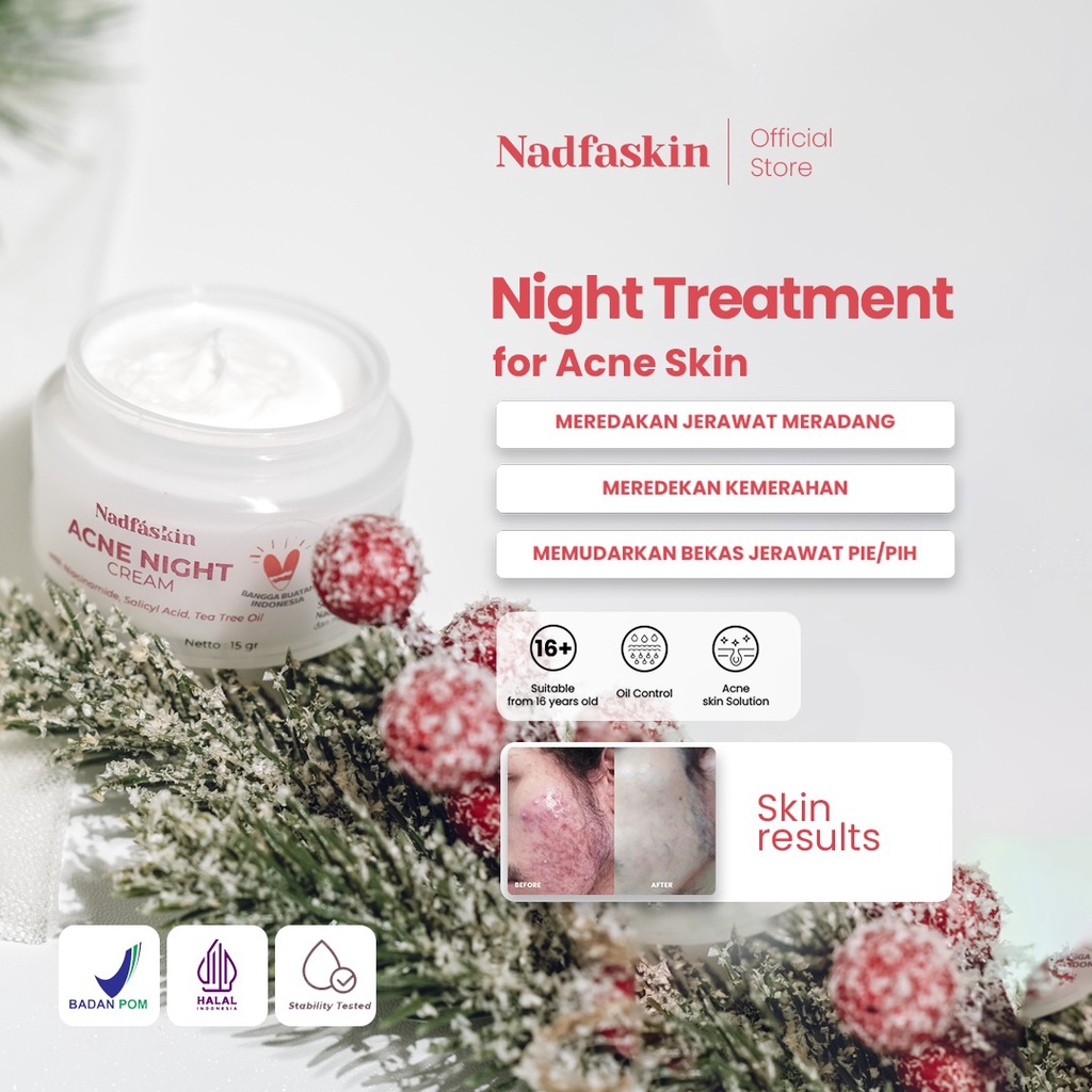[NEW PACKAGING] Acne Night Cream 15gr &quot;Nadfaskin&quot;