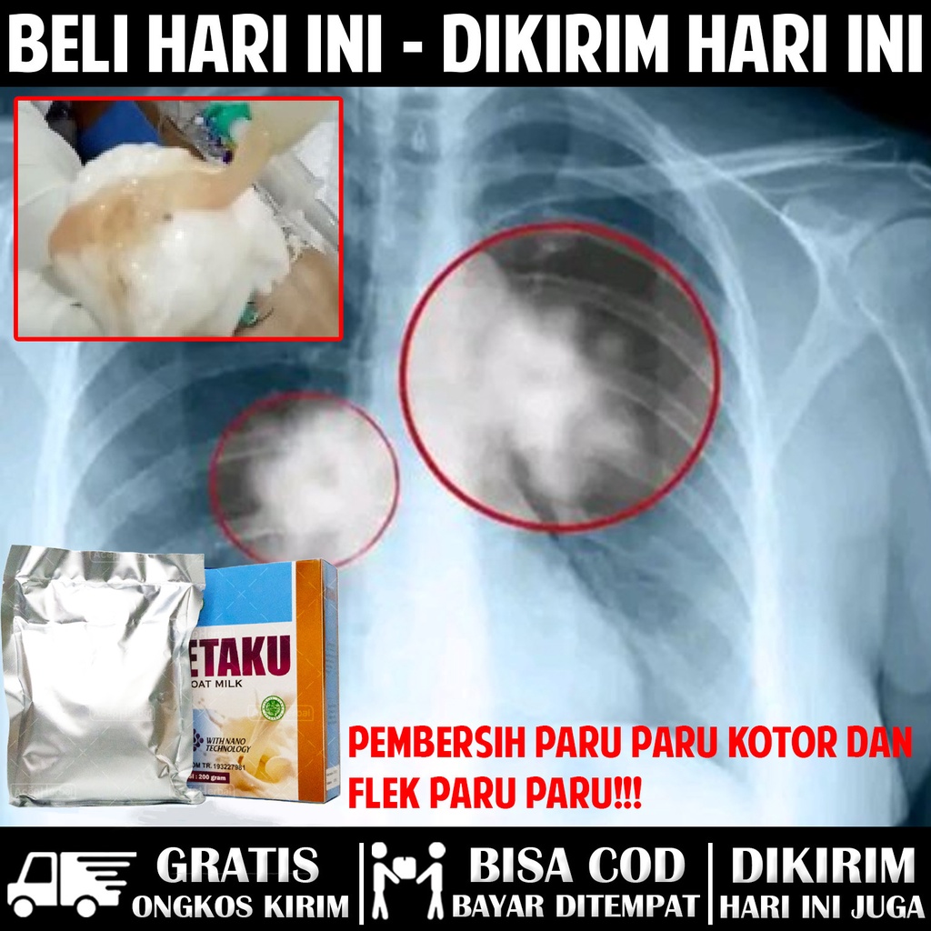 Jual Susu Pembersih Paru Paru Kotor Paru Paru Perokok Obat Flek Paru Paru Radang Paru 2219