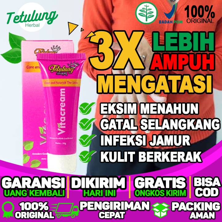 Vitacream Gatal Binahong Salep Gatal Selangkangan Dan Hitam Dijamin Ampuh Mengurangi Gatal Gatal