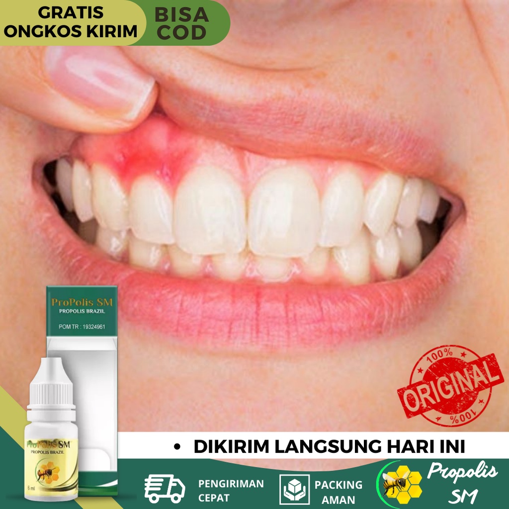 Obat Nyeri Gusi, Obat Gusi Bengkak, Obat Gusi Memerah dan Mudah Berdarah, Obat Nyeri Gusi Berdenyut,