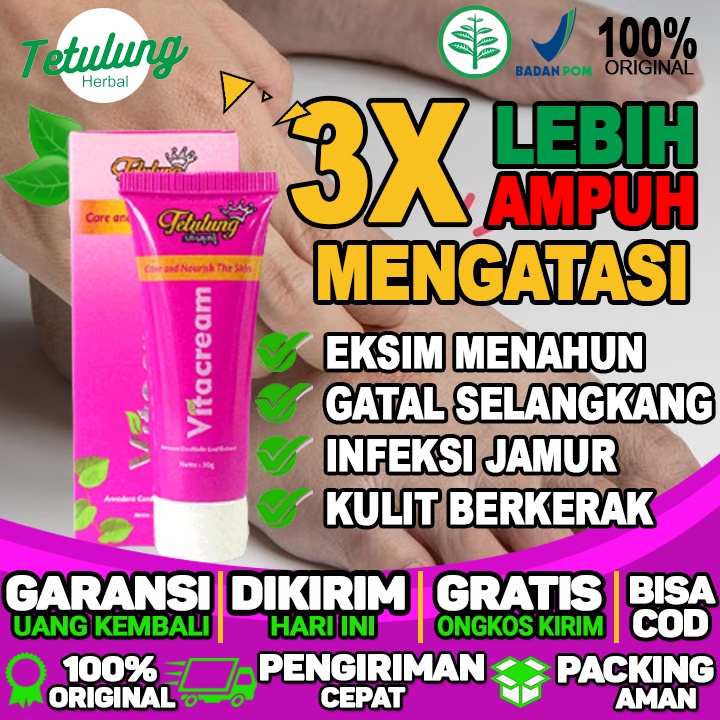 OBAT OLES VITACREAM OBAT GATAL SELANGKANGAN DAN INFEKSI MENAHUN