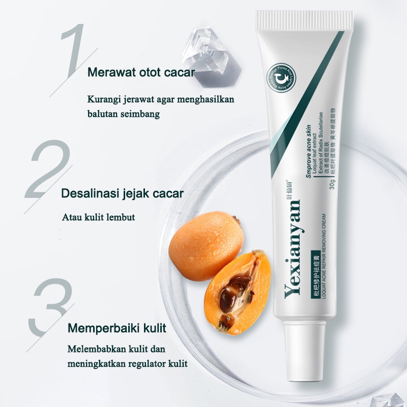 【ORANNLE】[100% Asli] Cream jerawat obat totol jerawat krim jerawat obat jerawat dan bekas jerawat Jerawat Removal of Acne Cream Untuk Pria dan Wanita