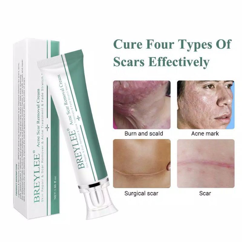 Breylee Acne Scar Removal Cream Menghilangkan Bekas Luka / Stretch Marks 30g