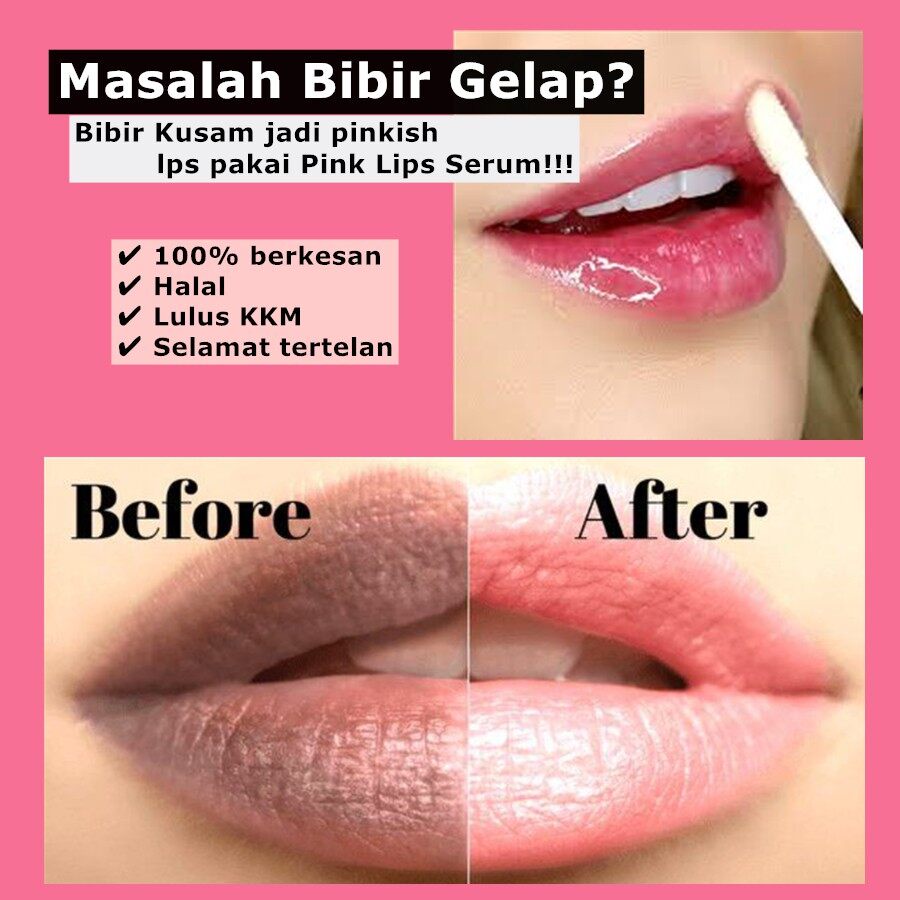 Masker bibir Pemerah bibir Lip balm 10g Tak ada efek samping mencerahkan warna bibir Singkirkan bibir kering dan pecah Kecilkan bibir kurangi ketebalan bibir  Ini bisa digunakan oleh pria, wanita dan wanita hamil