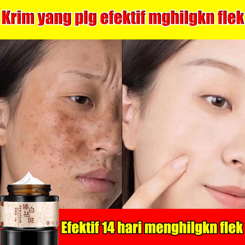 【COD】krim pemutih dan menghilangkan flek / krim pemutih wajah / memudarkan flek hitam menghilangkan jerawat / cepat menghilangkan bintik hitam menghilangkan flek hitam / menghilagkan bintik hitam / emmudarkan bintik hitam