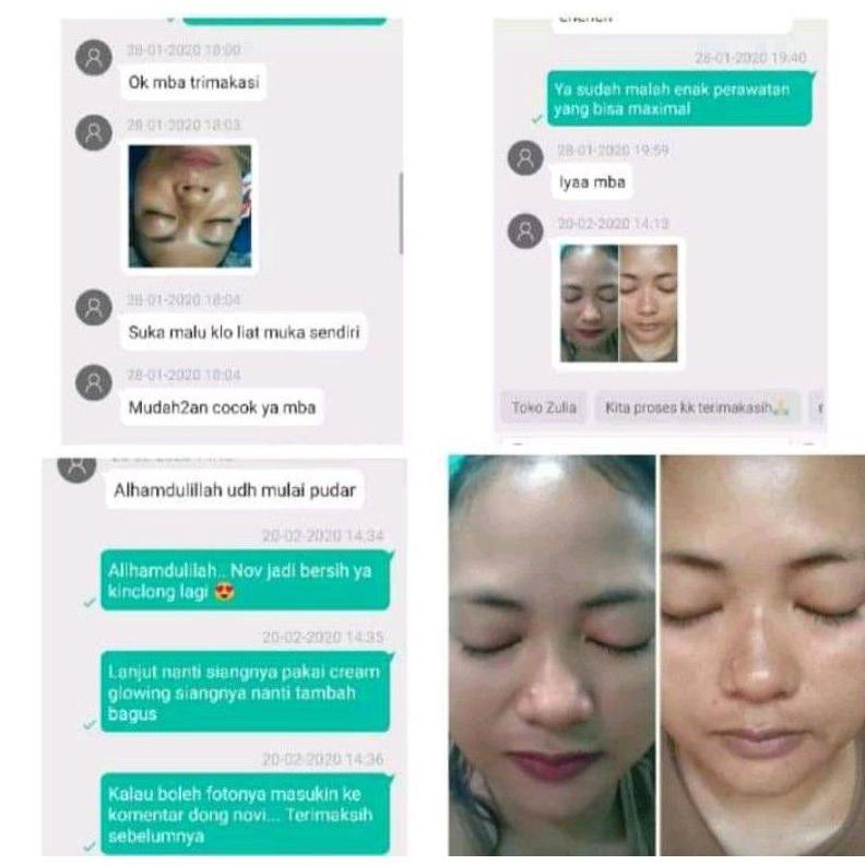 [M(29 ➸) Salep Flek dr Liz / Lis night Cream / Liz night whitening / saleb flek Lis skincare super k