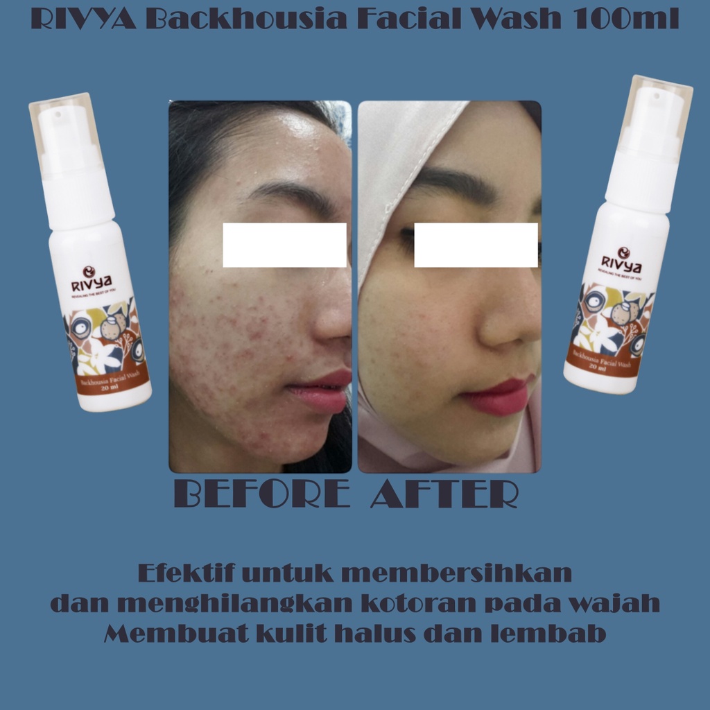 RIVYA Backhousia Facial Wash 100ml - Amaze_Kosmetik