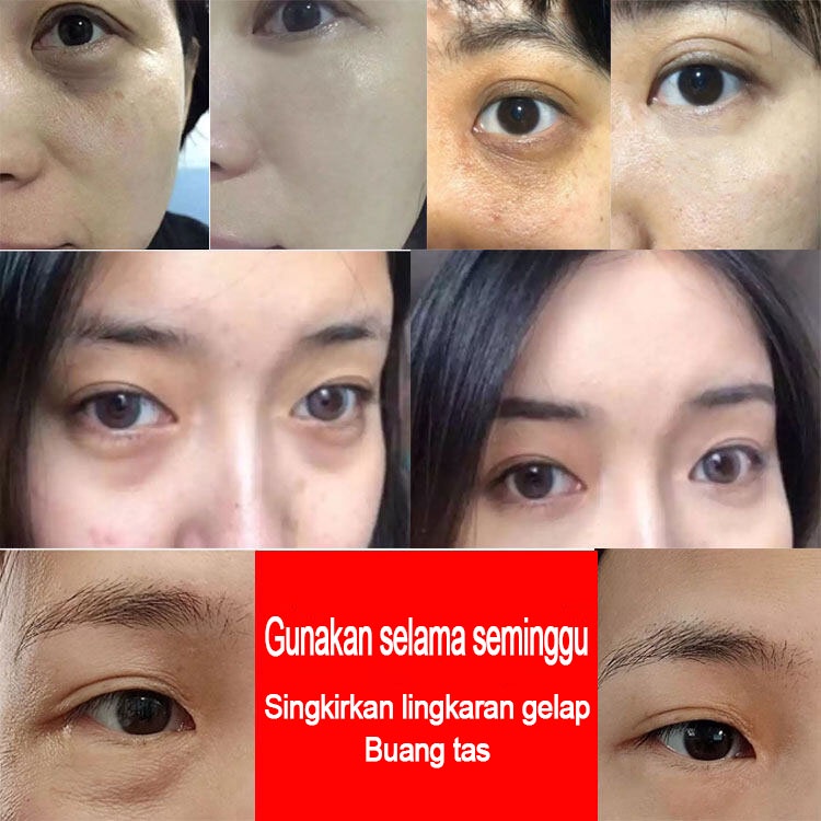 serum mata cream Kecantikan mata Krim mata panda 60g Eye cream Penghilang kantung mata Esensi pelembab Untuk Menghilangkan Kerutan Mata Dan Menyehatkan Kulit