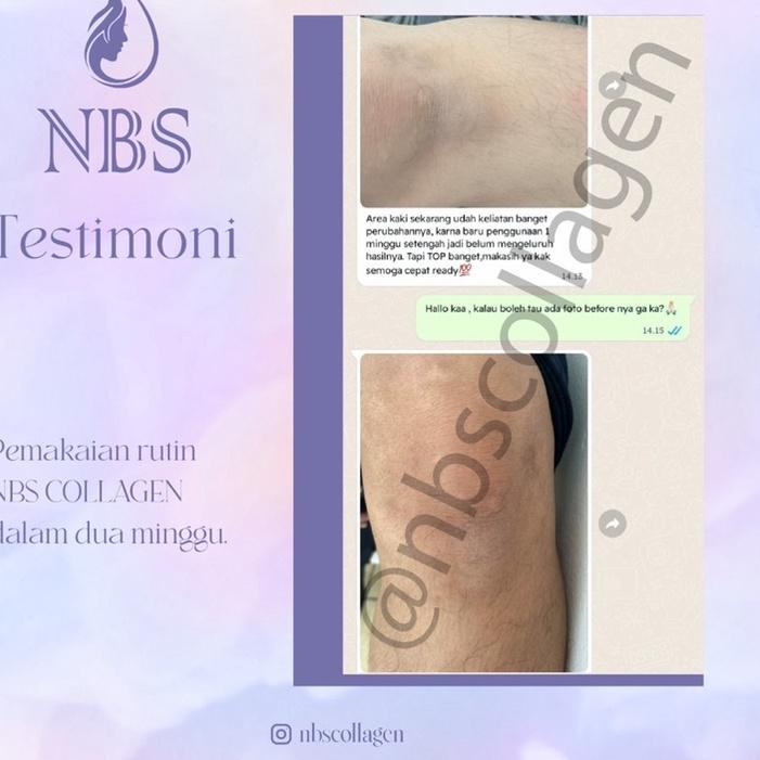 

3NY♕ Collagen Booster NBS Barang Baru