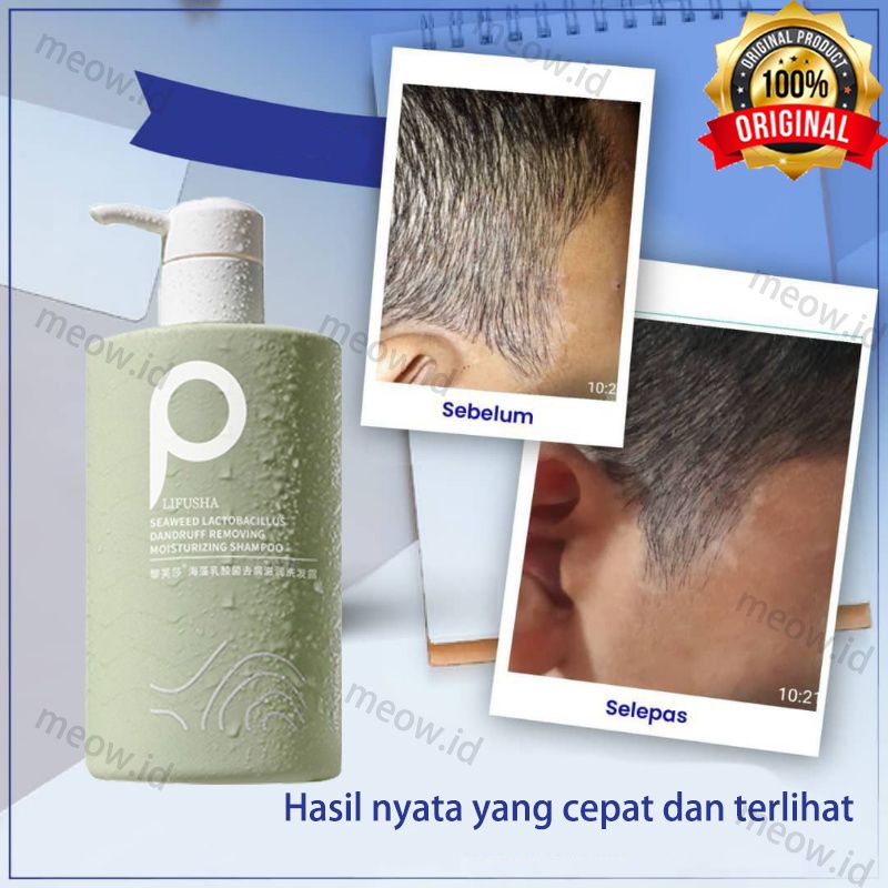 [COD] Shampo anti ketombe Sampo anti ketombe  anti ketombe Obat ketombe 500ml memperbaiki rambut kusut dan kontrol minyak shampo halus lembut dan anti lepek dandruff treatment dermatitis seboroik