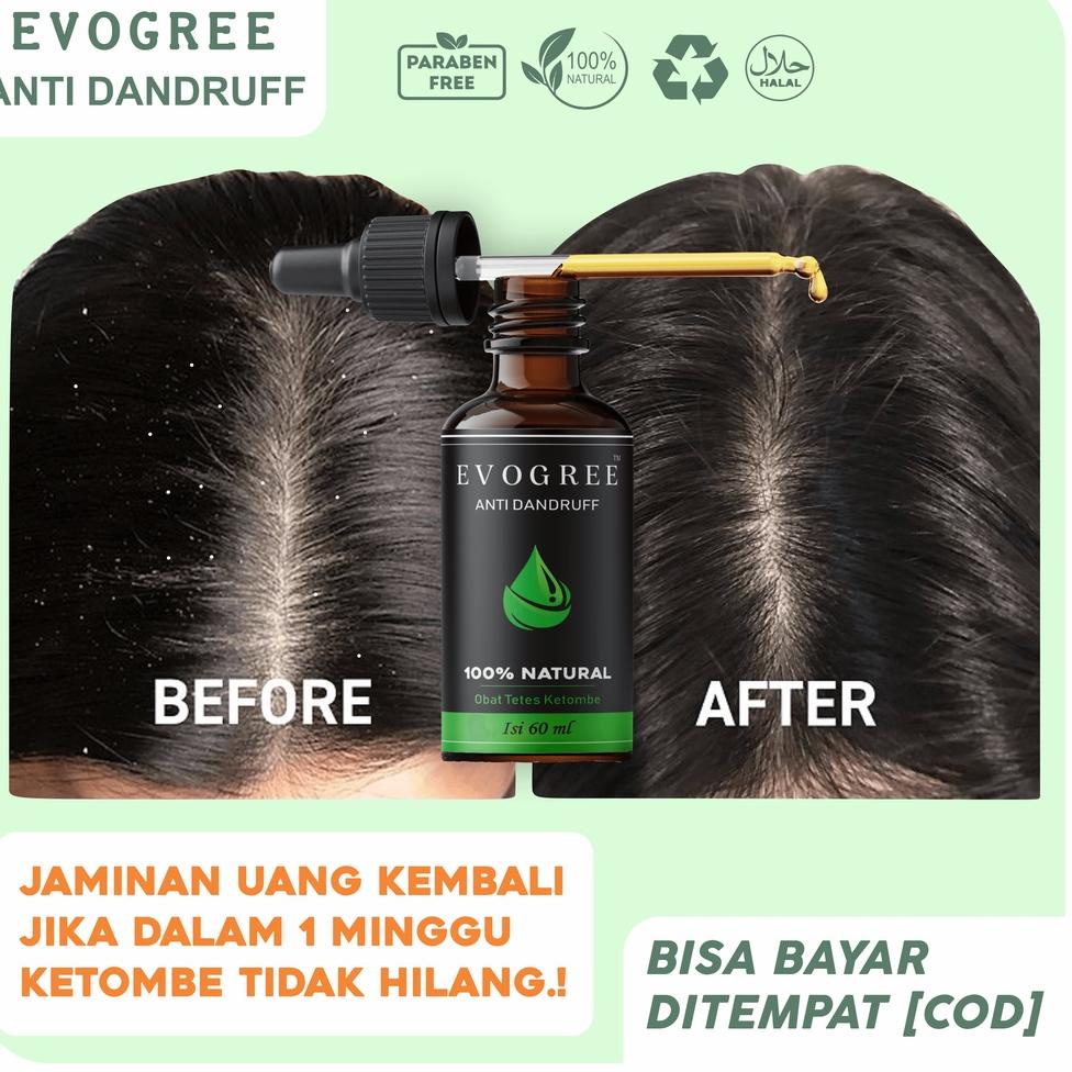 TERLARIZZZOBAT KETOMBE MEMBANDEL PALING AMPUH EVOGREE