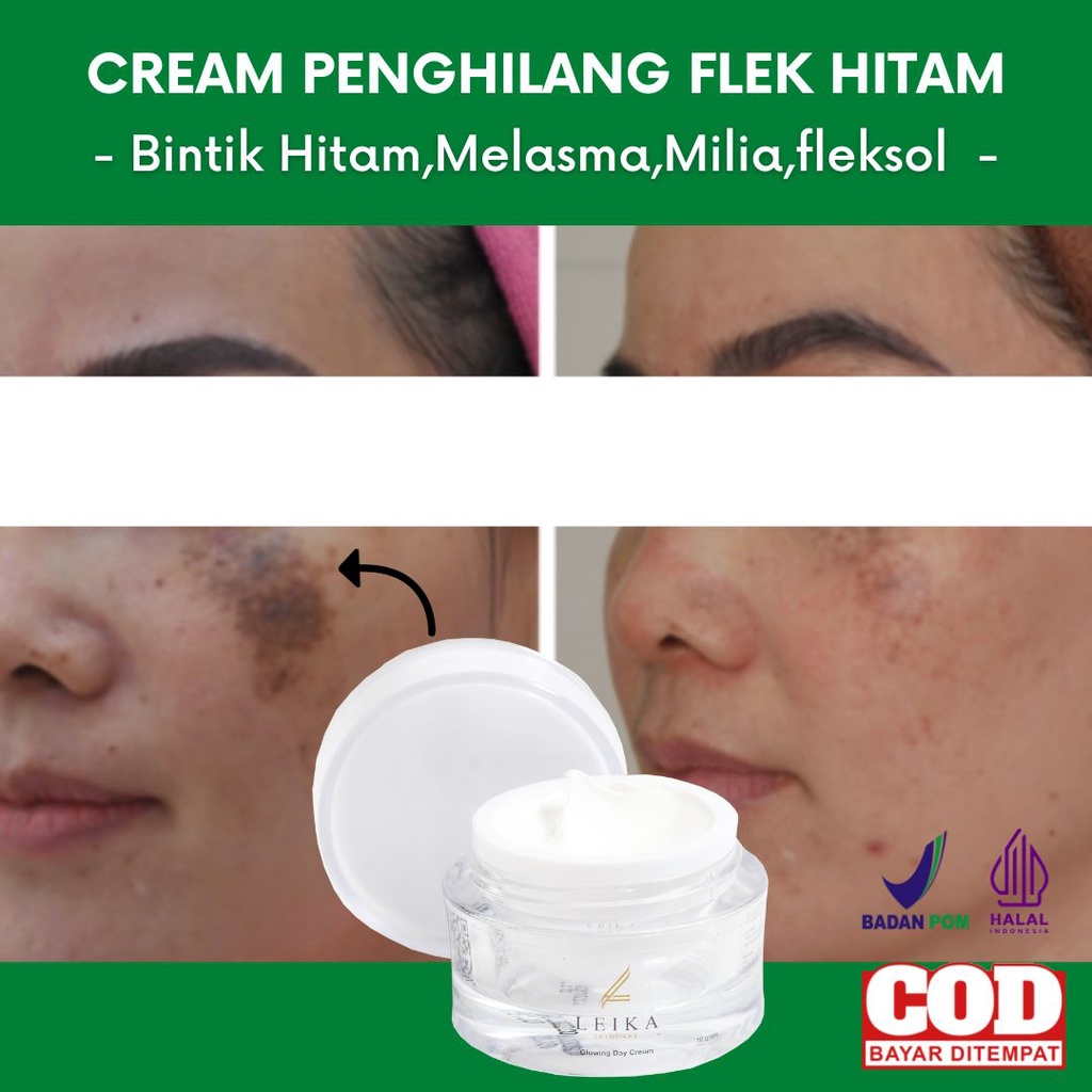 Obat flek hitam cream penghilang flek hitam penghilang flek hitam di wajah krim flek pembersih flek 
