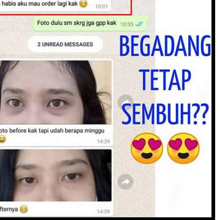 Terbaruナ ULTIMATE EYE GEL ORIGINAL BY NEBI /ULTIMATE EYE GEL BY NEBI EYE GEL /ULTIMATE EYE GELL ORIG