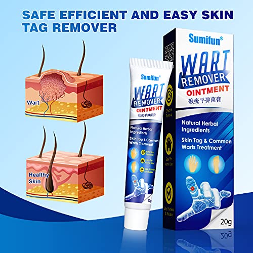 Salep 𝗦𝗮𝗺𝗶𝗳𝘂𝗻 𝗪𝗮𝗿𝘁 Removal Skin Tag Eelhoe Wart Remover Original 100%