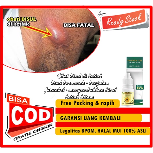 Obat bisul di ketiak - bisul bernanah - benjolan - furunkel - menyembuhkan bisul - ketiak hitam - me