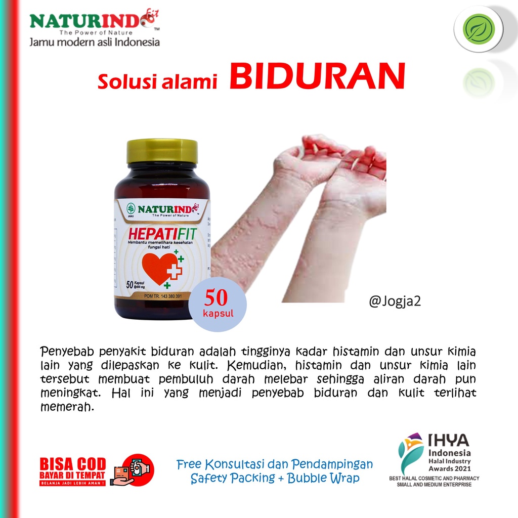 Biduran Alergi Gatal Alergi Dingin Gatal Biduran Kaligata Hepatifit BPOM Naturindo
