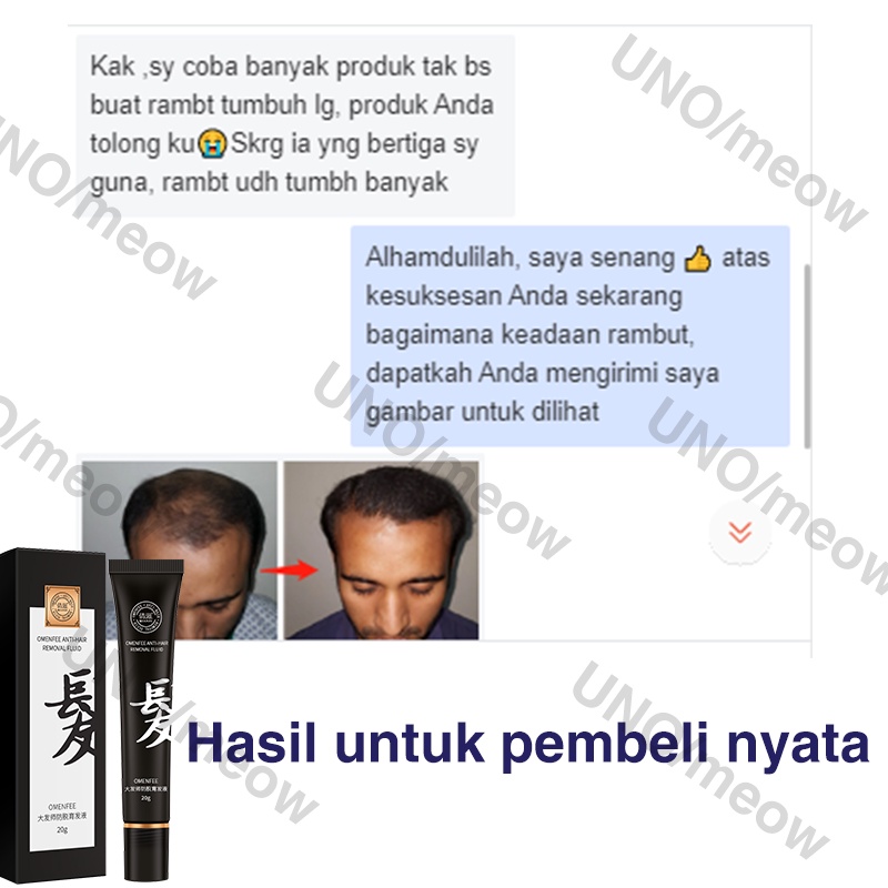 [2022 Terbaru] penumbuh rambut / penumbuh rambut botak / serum rambut rontok / 100%Asli Esensi Pertumbuhan Rambut Rollerball - Memijat pori-pori Mempercepat penyerapan Mempercepat pertumbuhan rambut 20ml