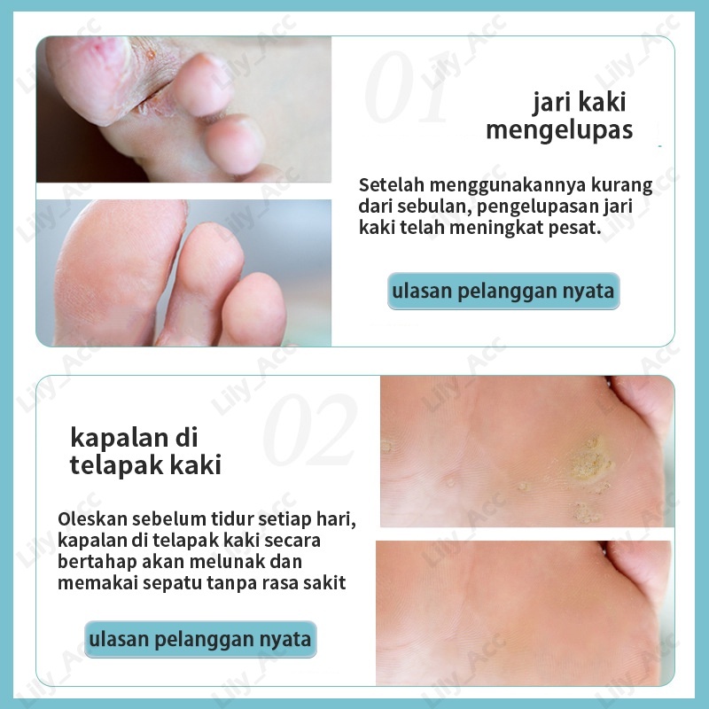 salep tangan dan kaki pecah / mengobati tumit kaki pecah , telapak tangan pecah , mengelupas, celah/ krim tangan , krim perbaikan / menghidrasi melembabkan, memperbaiki tumit kaki , telapak tangan