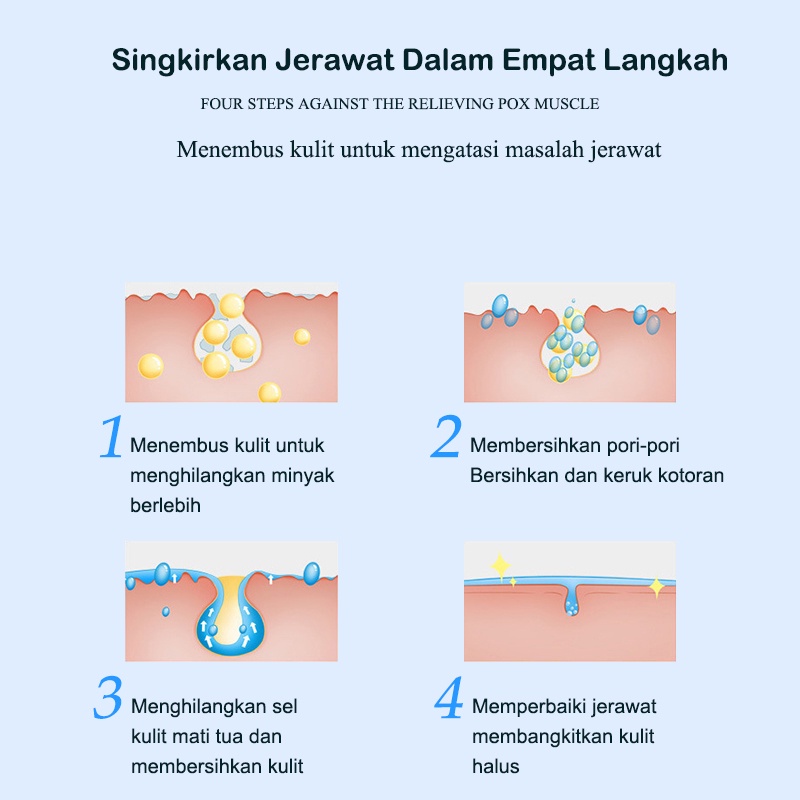 【ORANNLE】[100% Asli] Cream jerawat obat totol jerawat krim jerawat obat jerawat dan bekas jerawat Jerawat Removal of Acne Cream Untuk Pria dan Wanita