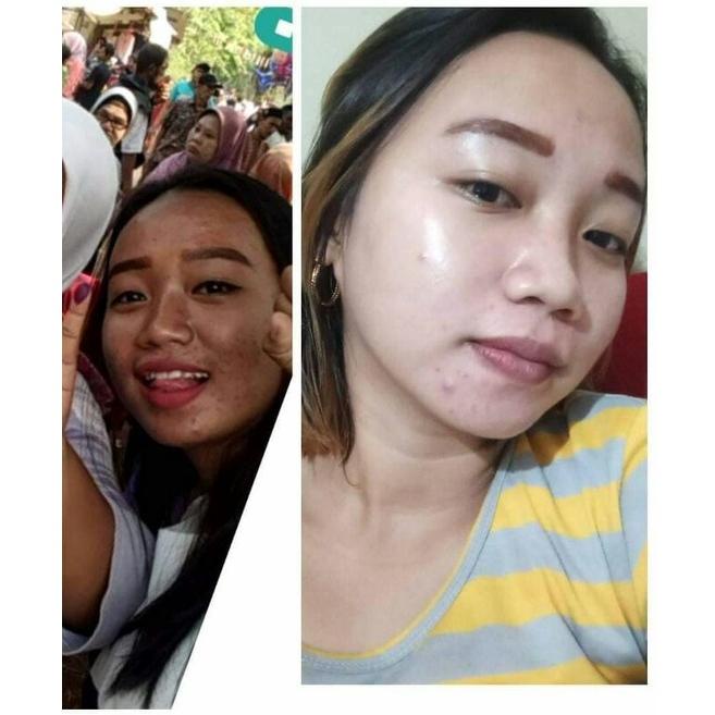 BISA COD BELI 3 GRATIS MINI GOLD Toner RS glowing original 30ml dan 60 ml dan cream+serum glowingMNN