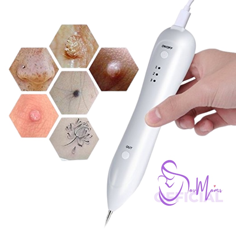 Penghilang Tahi Lalat Dark Spot Flek Hitam Bekas Luka Bakar Jerawat Membandel Perawatan Kecantikan Kulit Wajah Pria Wanita Elektrik Pen Laser Menghilangkan Pembersih Tato Tatto Sulam Alis Kutil Komedo Hidung Plek Hitam Di Wajah Permanen Premium Original